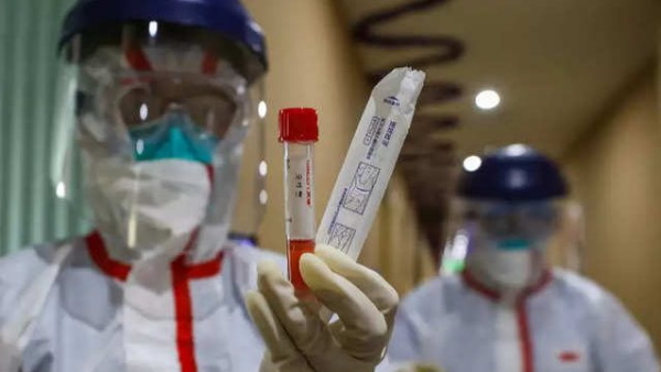 सोशल मीडिया पर झेलनी पड़ी आलोचना