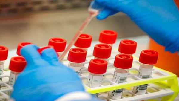 रिस्‍टबैंड में होंगे ये फीचर 