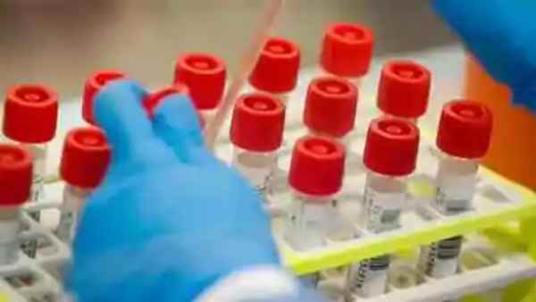 वैज्ञानिकों ने कहा कम से कम एक साल लगेगा