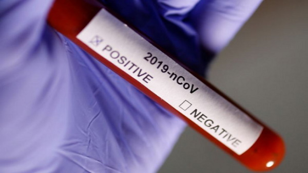 यूपी पुलिस भी रख चुकी है 10 हजार इनाम यूपी पुलिस भी रख चुकी है 10 हजार इनाम