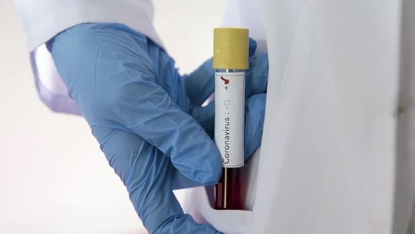 Bikaner woman Reported Corona Positive after her death Bikaner woman Reported Corona Positive after her death