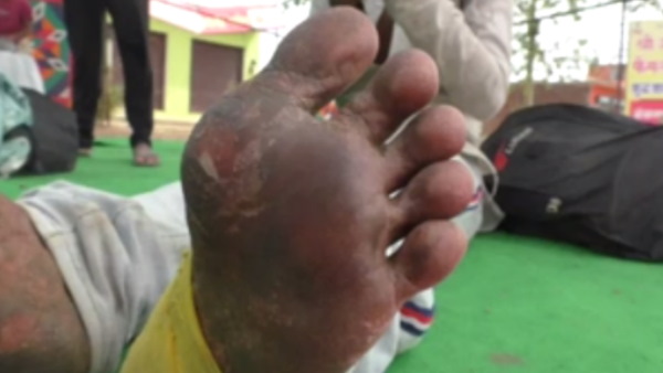 ग्रामीणाों ने जताई कोरोना फैलने की आशंका ग्रामीणाों ने जताई कोरोना फैलने की आशंका