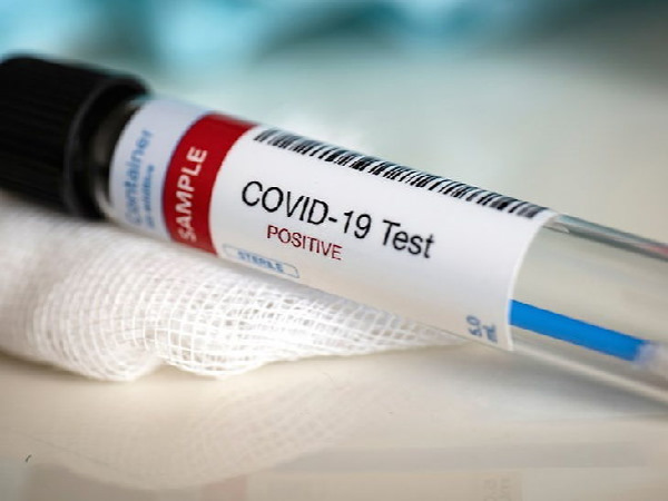 Amreli-district-of-Gujarat-also-has-a-positive-case-of-Covid-19