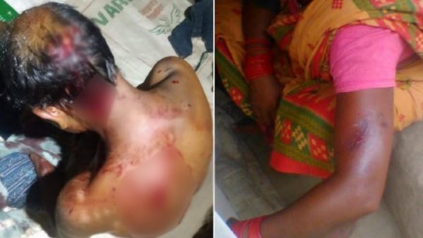 मजदूरों ने घर जाने को कहा तो ईंट भट्टे के मालिक ने बेरहमी से पीटा, तस्वीरों में बर्बरता मजदूरों ने घर जाने को कहा तो ईंट भट्टे के मालिक ने बेरहमी से पीटा, तस्वीरों में बर्बरता