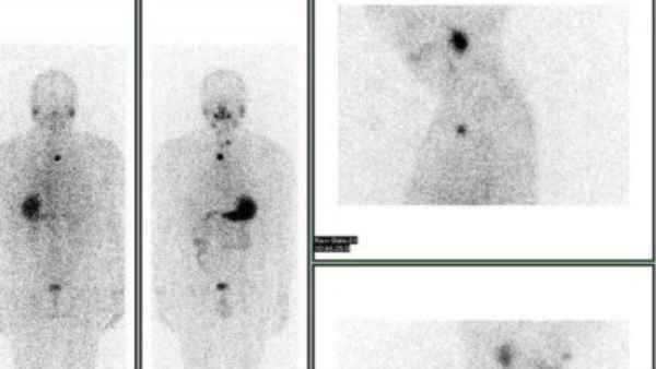 आइसोटोप क्या हैं ? 