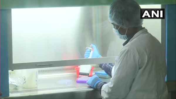 WB-Local firm makes indigenous testing kit of Coronavirus,Claims of providing up to 3 lakh kits daily WB-Local firm makes indigenous testing kit of Coronavirus,Claims of providing up to 3 lakh kits daily