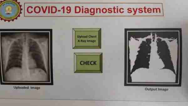 Coronavirus patients will be identified with chest X-rays