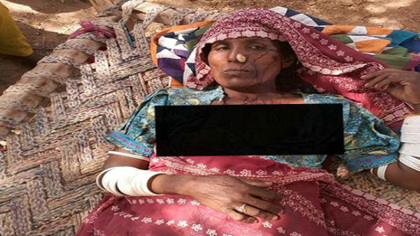 हिंदू-विरोधी हिंसा की तस्वीरें पश्चिम बंगाल की बताकर वायरल की