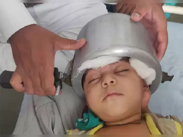 देखकर डॉक्टर्स भी दंग रह गए देखकर डॉक्टर्स भी दंग रह गए