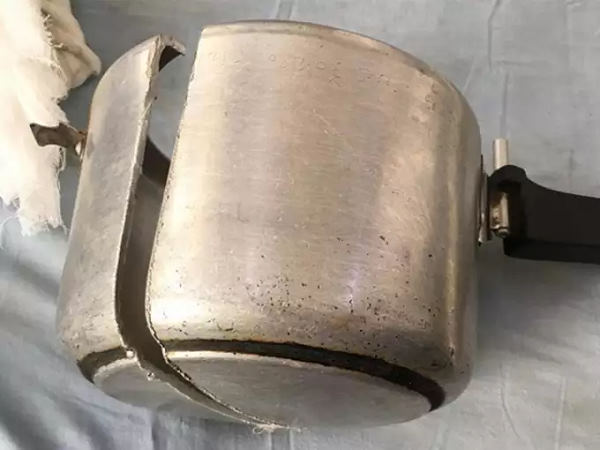 फिर उसे बचाने के लिए कुकर काटी फिर उसे बचाने के लिए कुकर काटी