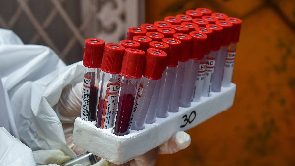 दिल्ली में शुरू होगा तीसरा सीरोलॉजिकल सर्वे दिल्ली में शुरू होगा तीसरा सीरोलॉजिकल सर्वे