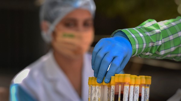 कोरोना के कुल केस 31 लाख के पार