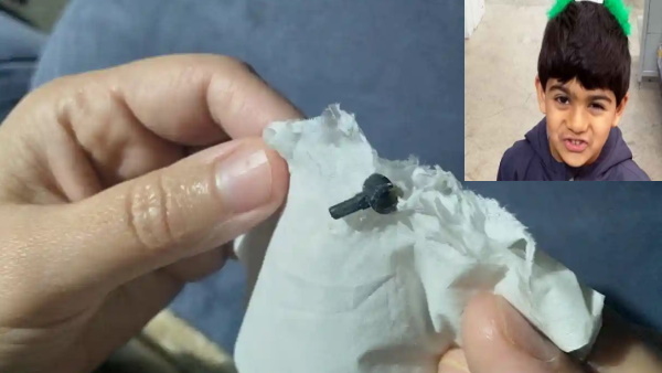 खेलते-खेलते चला गया नाक में खेलते-खेलते चला गया नाक में