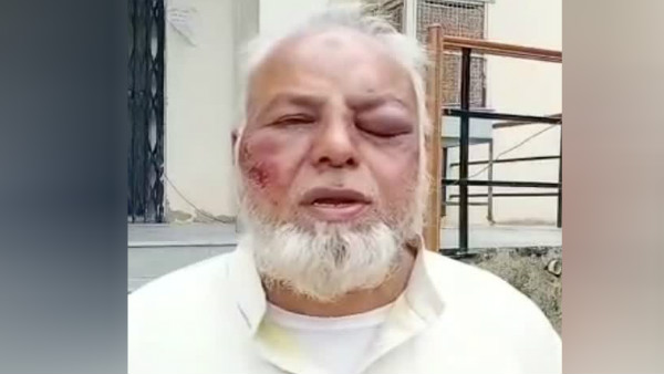 दाढ़ी भी नोच ली