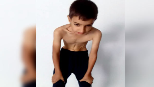 कई योग क्रियाएं कर लेता है दिव्यंक