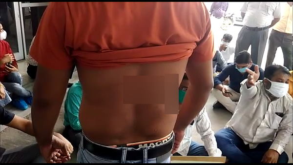Gorakhpur: In BRD Medical College, Junior doctors beaten a lab technician, checkup closed in hospital