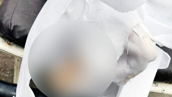 जब शव पड़ा पड़ा बन गया कंकाल जब शव पड़ा पड़ा बन गया कंकाल