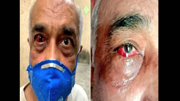 क्‍या कहना है पुलिस का