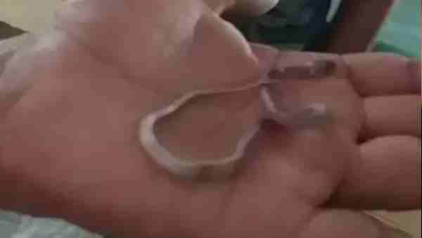 7 इंच का था सांप, इस वजह से हुई मौत 7 इंच का था सांप, इस वजह से हुई मौत