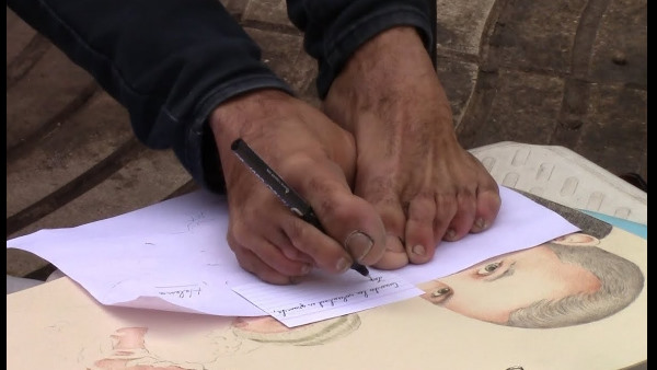 छह साल की उम्र में कटे हाथ छह साल की उम्र में कटे हाथ