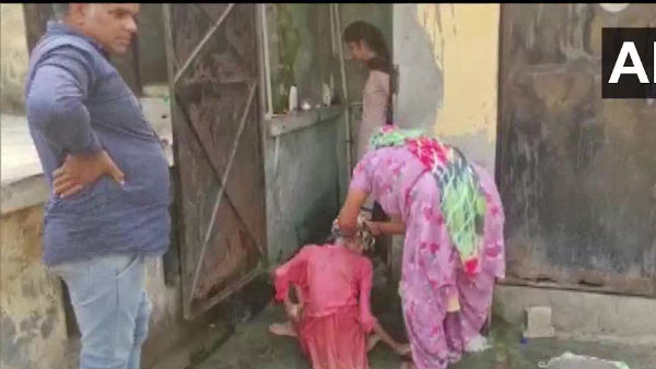 शरीर हड्डियों के ढांचे में बदला 