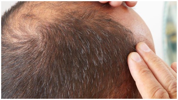 पति की जमानत याचिका खारिज