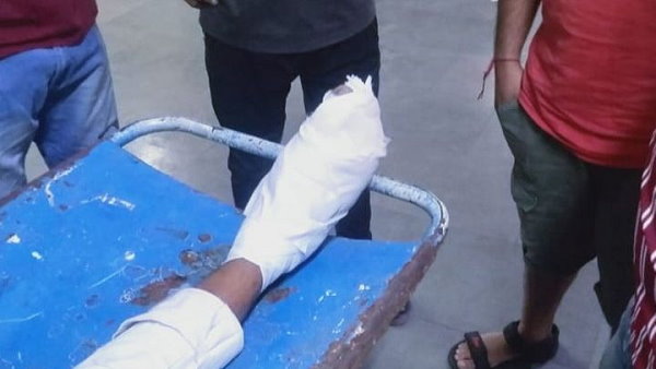 Near Surat Civil Hospital , Ambulance hits a Bike Rider, and then Brought him to hospital Near Surat Civil Hospital , Ambulance hits a Bike Rider, and then Brought him to hospital