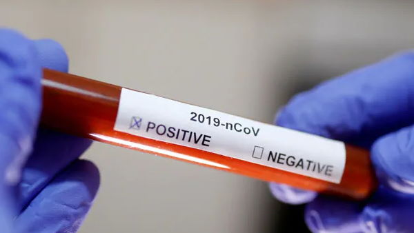 new strain or mutation of Coronavirus seen in the United Kingdom has not been seen in India new strain or mutation of Coronavirus seen in the United Kingdom has not been seen in India