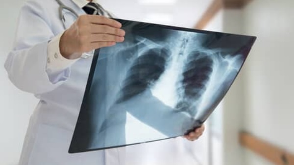 लगातार उल्टियां कर रहा था मासूम