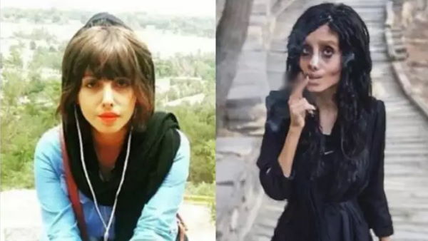 करा चुके हैं पचास सर्जरी करा चुके हैं पचास सर्जरी