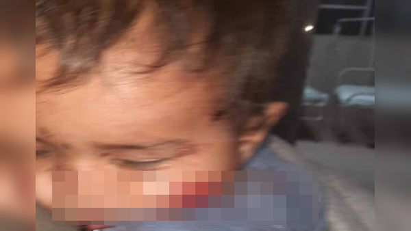 दोनों बहन भाई महात्मा गांधी अस्पताल में भर्ती 