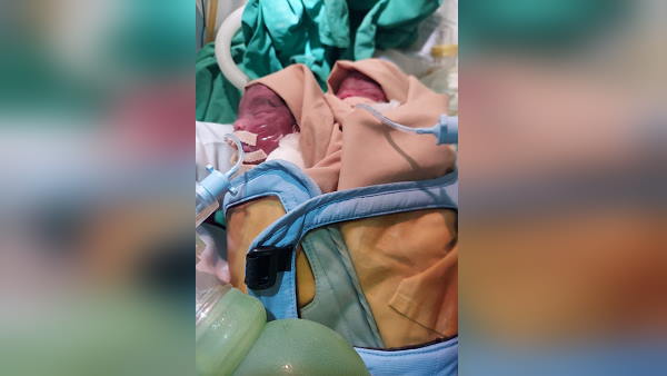 in gujarat, a pregnant woman give birth twins in five months, doctors save them in gujarat, a pregnant woman give birth twins in five months, doctors save them