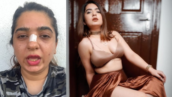 हितेशा ने हादसे वाले दिन को लेकर क्या कहा?