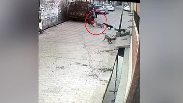 street dogs attacks on 7 year old girl in aligarh street dogs attacks on 7 year old girl in aligarh