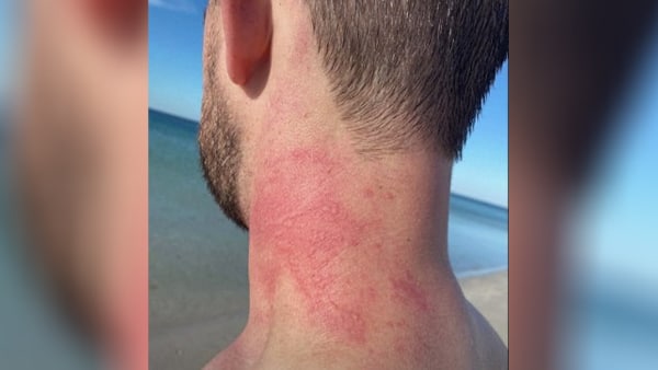 सबसे गुस्सैल ऑक्टोपस