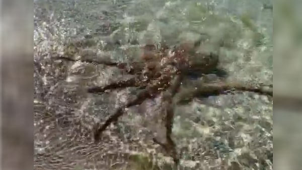 चोट पर कोल्ड ड्रिंक्स