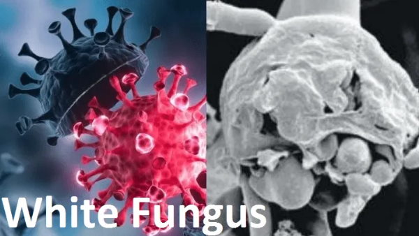 व्हाइट फंगस सिर्फ एक मिथक और गलत धारणा है