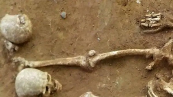 इस वजह से हो सकती है ऐसी बनावट इस वजह से हो सकती है ऐसी बनावट