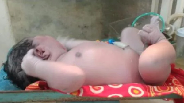 कोरोना के डर से महिला को देर से लेकर पहुंचे अस्पताल