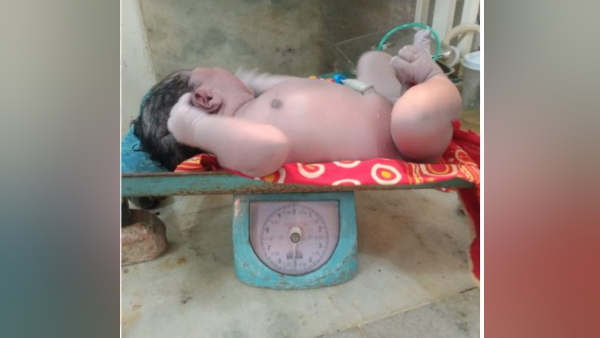 असम में पैदा हुआ सबसे वजनी बच्चा