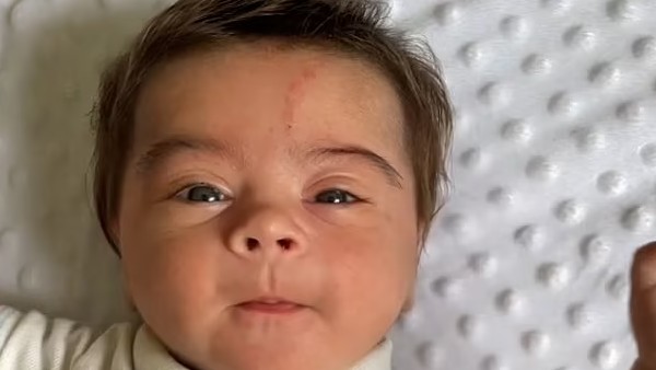 हर हिस्से में बढ़ रहे बाल