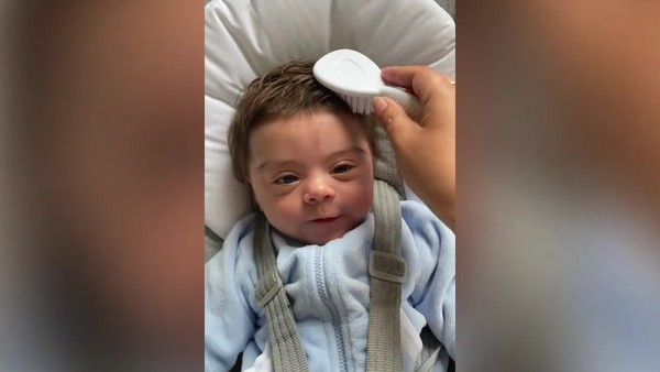 डॉक्टरों ने बताई वजह