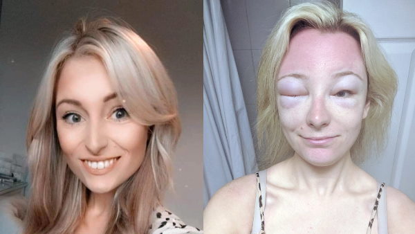 शीशे में खुद की शक्ल देख डर गई युवती