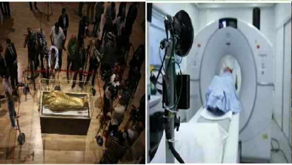 इटली में किसकी ममी का सीटी स्कैन हो रहा है ? इटली में किसकी ममी का सीटी स्कैन हो रहा है ?