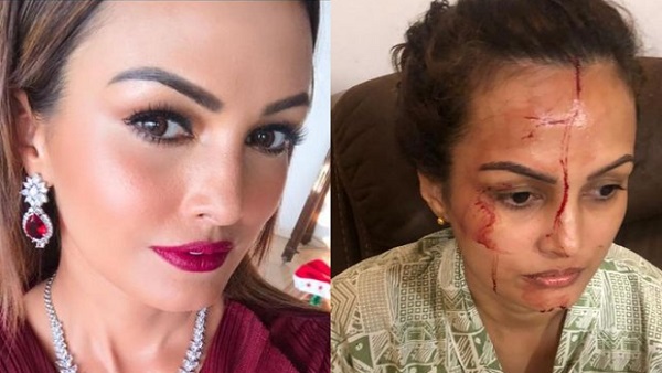 'जब करण ने पहली बार हाथ उठाया तब ही निशा को सामने आना चाहिए था'