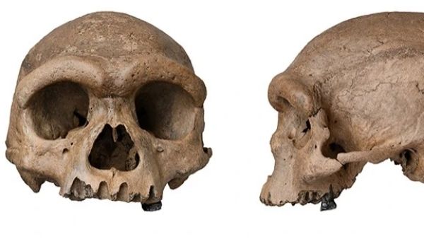 खोपड़ी पर खुलासा खोपड़ी पर खुलासा