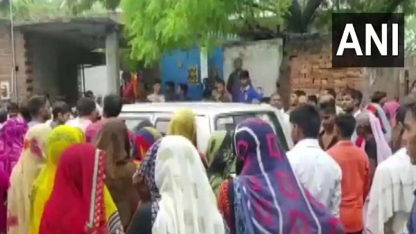 तीन सिर वाले बच्चे ने लिया जन्म तीन सिर वाले बच्चे ने लिया जन्म