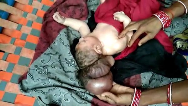 भगवान समझ लोग कर रहे पूजा भगवान समझ लोग कर रहे पूजा