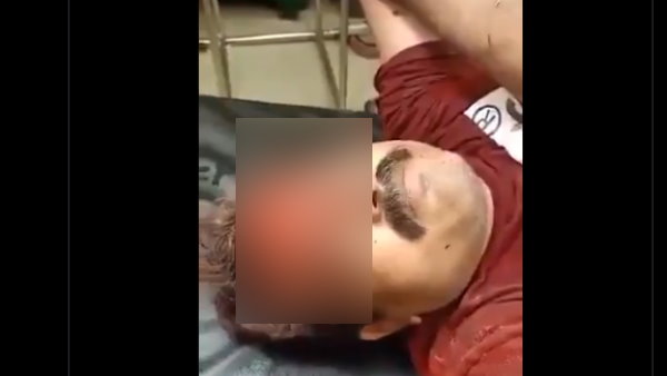 Journalist accused BJP MLA for attack on him