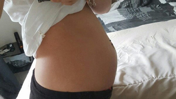 जुड़वां बच्चों की थी उम्मीद लेकिन हुआ एक बच्चा